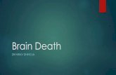 Brain death