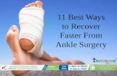 11 best ways to recover faster from ankle surgery
