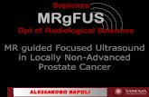 MRgFUS in Locally Non-Advanced Prostate Cancer