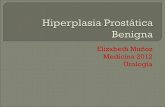 Hiperplasia Prostatica benigna