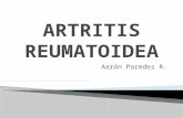 Artritis rematoidea