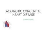 Acyanotic congenital heart disease