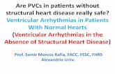 Are pv cs in patients without structural heart disease really safe samir rafla