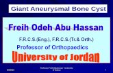 Giant bone cysts - البروفيسور فريح ابوحسان - استشاري اورام العظام في الاردن