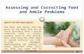 Assessing and correcting foot and ankle problems