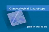 Gynaecological laproscopy jagdish ola