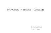 Imaging in breast cancer