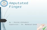 Amputated finger
