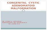 Congenital cystic adenomatoid malformation