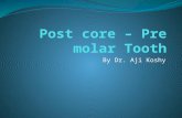 Post core – Pre molar Tooth