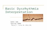 Basic Dysrhythmia Interpretation