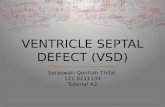Ventricle Septal Defect (VSD)