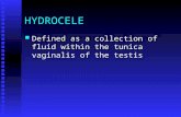 Hydrocele Varicocele