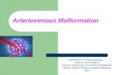 Vascular Malformations Sd