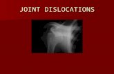 Joint Dislocations