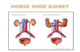Horse Shoe Kidney