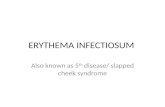 Erythema Infectiosum