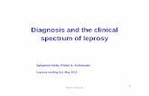 Diagnosis and the Clinical Spectrum of Leprosy