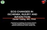 ECG PLD Ischemia and Infarction (Daniel)