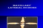 Maxillary & Mandibular Lateral Incisor