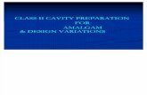 52589890 Class II Amalgam Cavity Preparation for Amalgam