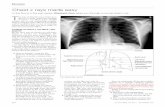 Radiographie Thoracique Pour Les Nuls - Chest X-Ray Made Easy - Coursmedecine.com