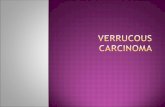 Verrucous Carcinoma.ppt