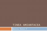 Tinea Amiantacea