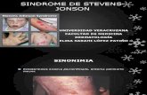 Sindrome de Stevens-jonson