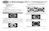 4.Neurology II Hemorrhagic Stroke 2014A