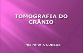 TOMOGRAFIA DO CRÂNIO