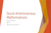 Dural Arteriovenous Malformation presentation