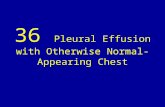 36 pleural effusion with otherwise normal appearing chest