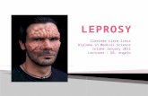 Leprosy by clare