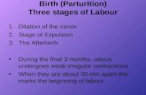 Birth (parturition)