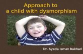 Approach to a child with dysmorphism