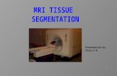 MRI Tissue Segmentation basics