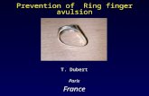 Prevention of ring finger avulsion ("degloving"