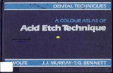 Acid Etch Technique