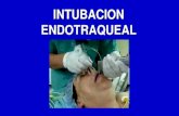 intubacion endotraqueal.ppt