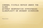 Coronal fistula repair under the glans.pptx