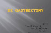 D2 Gastrectomy