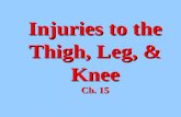 Injuries to the Thigh, Leg, & Knee (Ch. 15)