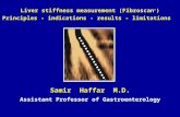 Liver stiffness measurement (Fibroscan ® ) Principles - indications - results - limitations Samir Haffar M.D. Assistant Professor of Gastroenterology.