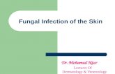 Fungal Infection of the Skin Dr. Mohamad Nasr Lecturer Of Dermatology & Venereology.