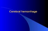 Cerebral hemorrhage. Etiology and pathogenesis Hypertension and arteriosclerosis Atherosclerosis, bleeding tendency (hemophilia, leukemia, aplastic anemia,