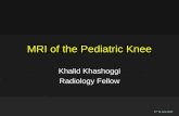 MRI of the Pediatric Knee Khalid Khashoggi Radiology Fellow 17 th of June 2012.