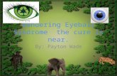 Wandering Eyeball Syndrome the cure is near. By: Payton Wade.