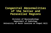 Congenital Abnormalities of the Sellar and Parasellar Regions Division of Neuroradiology Department of Radiology University of North Carolina at Chapel.