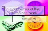 Lymphomas of the Head and Neck Tal Marom, MD. Lymphoma Cancer of the lymphatic system Cancer of the lymphatic system Lymphoma is differentiated by the.
